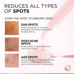 Skin spot reduction chart with close-up areas for sun, post-acne, and age spots