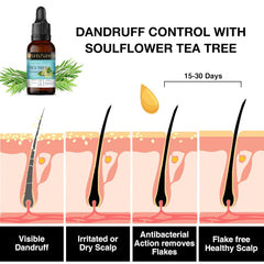 Tea tree essential oil dropper bottle with leaf illustrations and dandruff-control chart