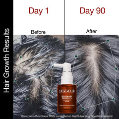 Hair growth serum bottle with before and after scalp results graphic