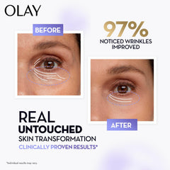 Olay Retinol Max before-and-after face illustration focused on the eye area