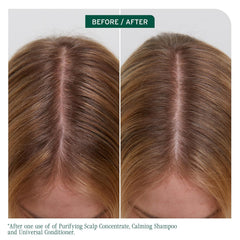 Scalp Sync before/after scalp close-ups showing improved hydration and scalp coverage