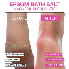Epsom bath salt magnesium sulphate before-and-after leg infographic