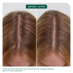 Scalp before-and-after photo with visible hair part and improved coverage