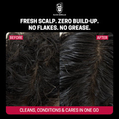 Hair and scalp before/after panel showing reduced flaking after treatment