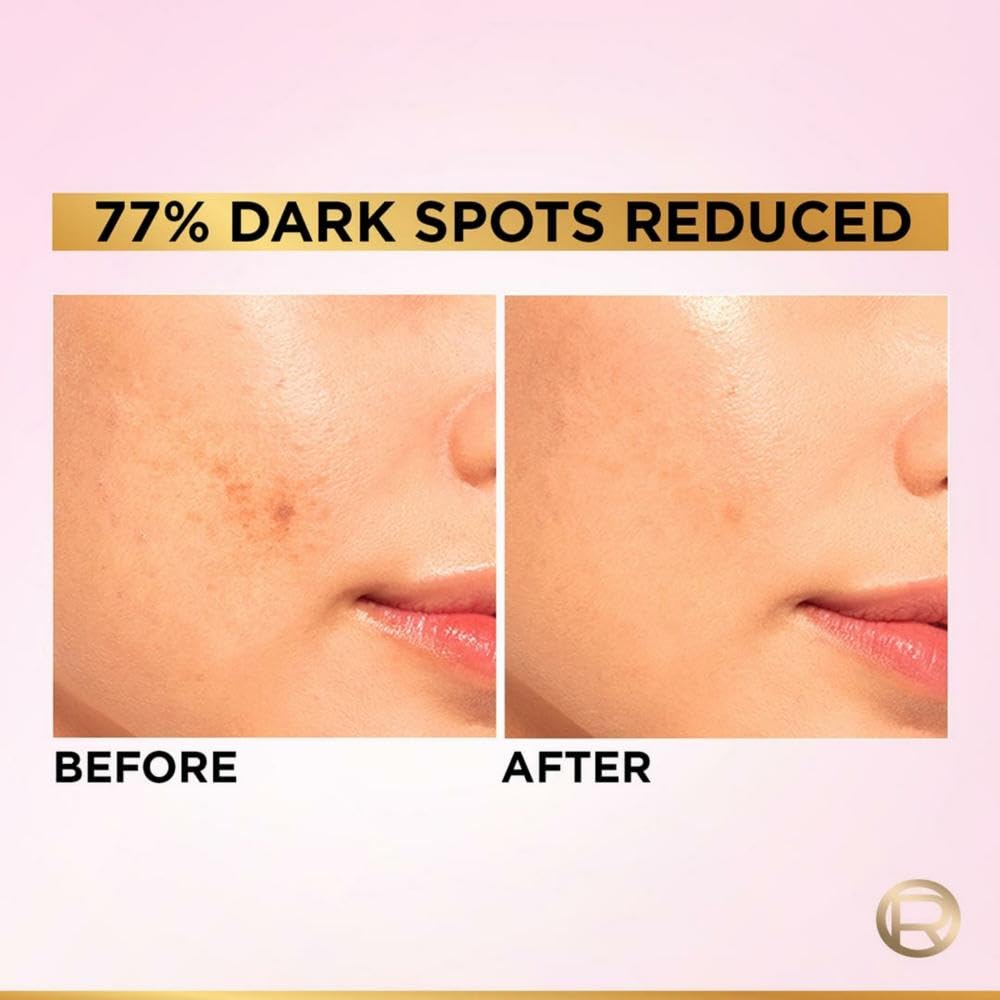 L'Oreal Paris - Glycolic Bright Melasyl + Niacinamide Serum for Brightening Dark Spots 15ml