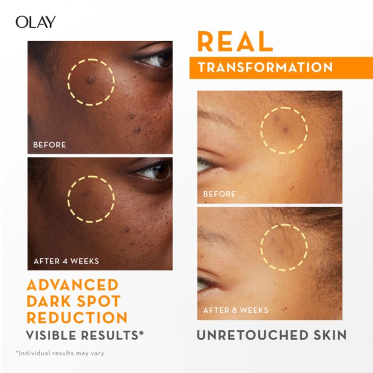 Olay Vitamin C Kit Glow Cream 50g with Cleanser 100g