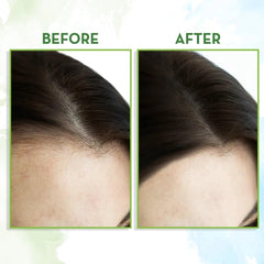 Mamaearth - Rosemary Essential Oil for Hair Growth 15ml