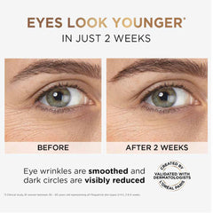 L'Oreal Paris - Revitalift 1.5% Hyaluronic Acid+1% Caffeine Eye Serum for Dark Circles 20ml