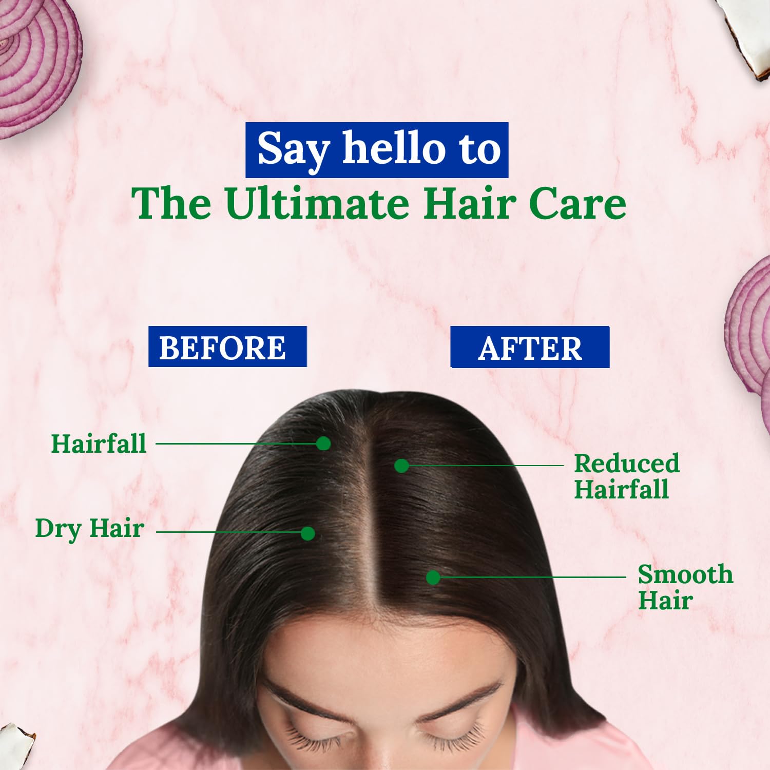 Parachute Advansed Onion Hair Oil - Hair Growth & Reduces Hairfall 200 ml