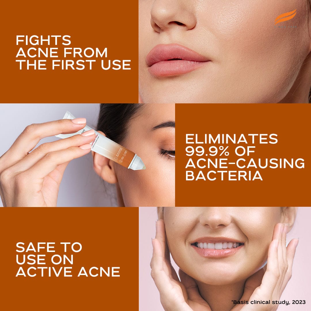 Himalaya - Acne Clear+ Spot Treatment Pen with 2% Natural Salicylic Acid Reducing Acne Size in 24 hrs 15ml