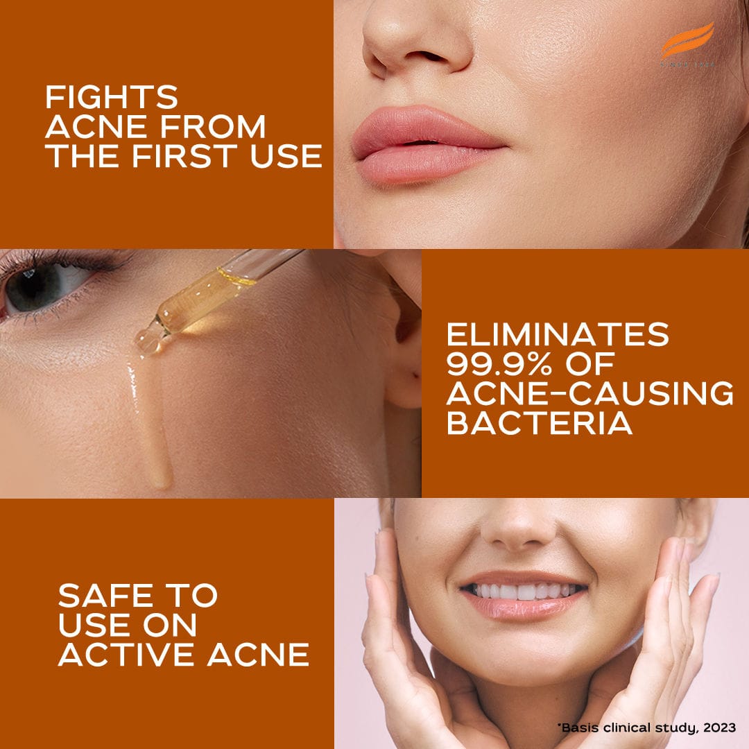 Himalaya - Acne Clear+ Scar Removal Serum with 2% Natural Salicylic Acid Reducing Acne & Pigmentation 30ml