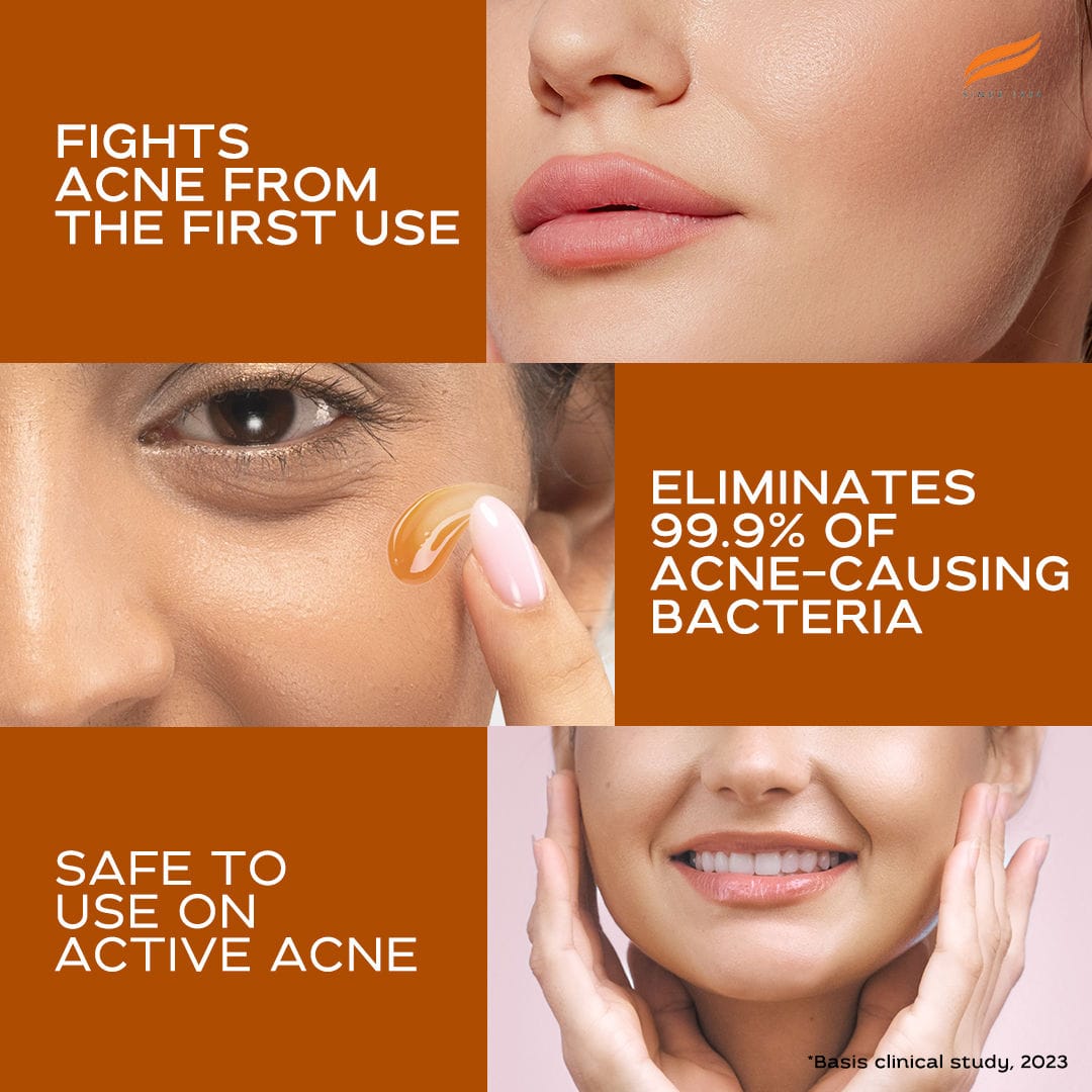Himalaya - Acne Clear+ Moisturizing Gel with Natural Salicylic Acid For Active Acne & Oily Skin 50ml